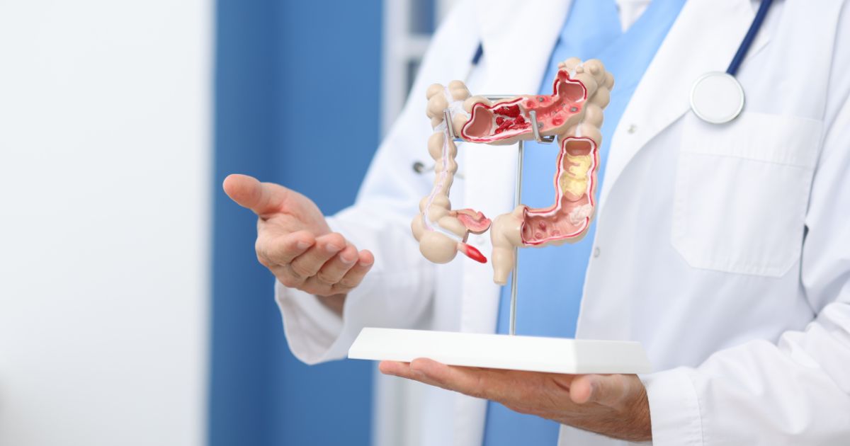 H. Pylori e gastrite crônica