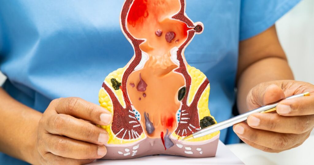 H. Pylori sem sintomas