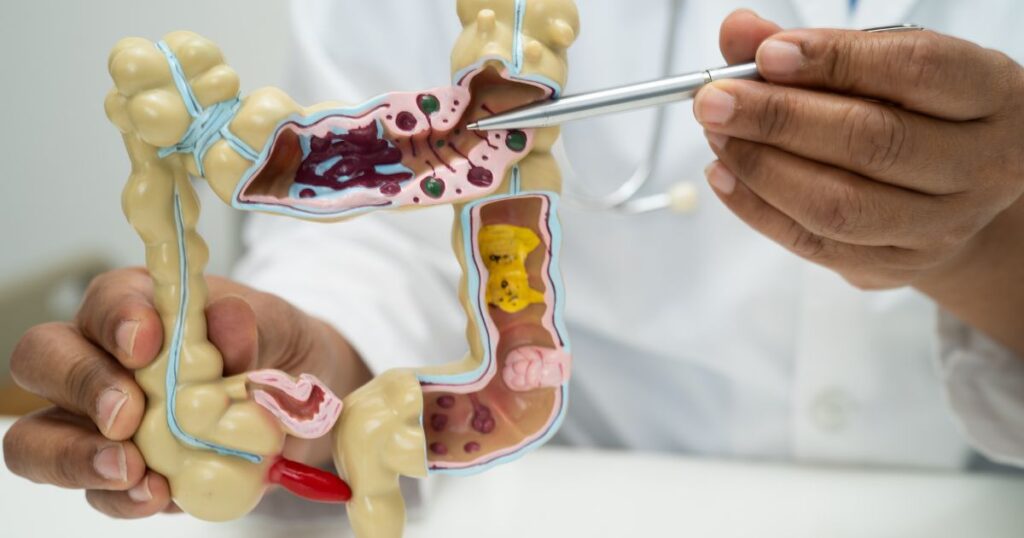 o que é disbiose intestinal